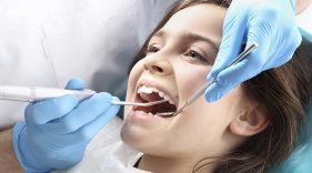 Professional cleanings go beyond your standard brushing and flossing.