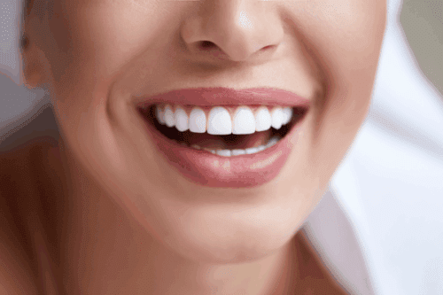 Teeth whitening: Dos and don’ts of brightening your smile