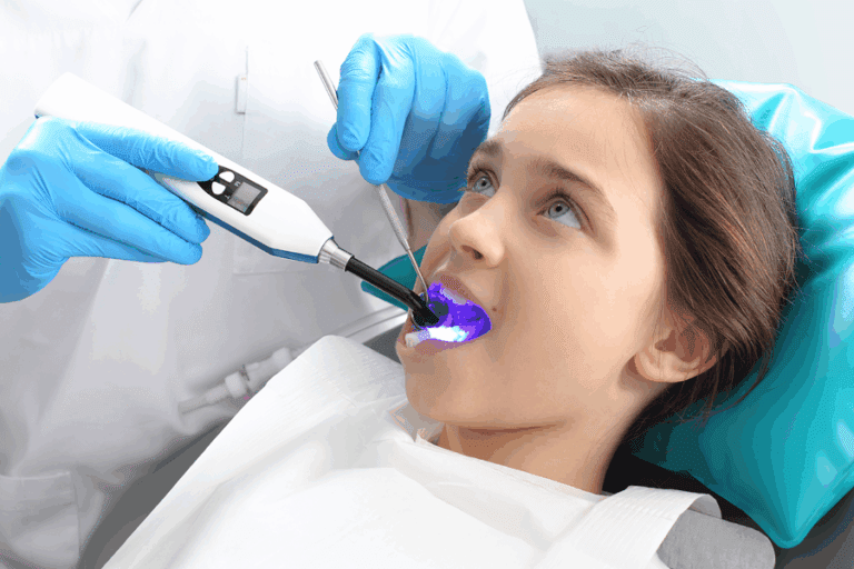 What are dental sealants?